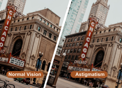 What Is Astigmatism, and Can It Be Corrected?