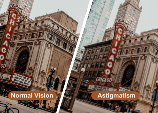 What Is Astigmatism, and Can It Be Corrected.png